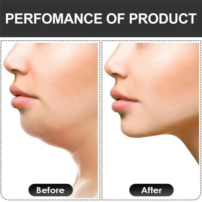 Exercice de mâchoire en forme de U, nouvelle bouche faciale, ligne de mâchoire, Fitness, balle à mâcher musculaire, disjoncteur de morsure, équipement d'entraînement